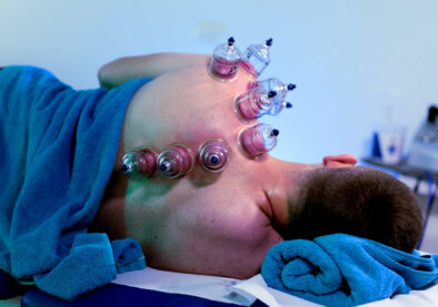 vakumska terapija Center fizioterapije Šepul