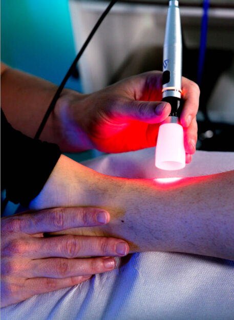 Lezije peronealnih mišic