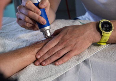 udarni valovi zapestje