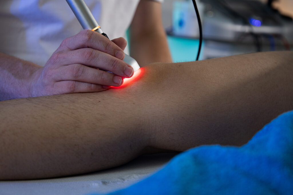 Laserska terapija HILT pri patelarni tendinopatiji oziroma skakalnem kolenu