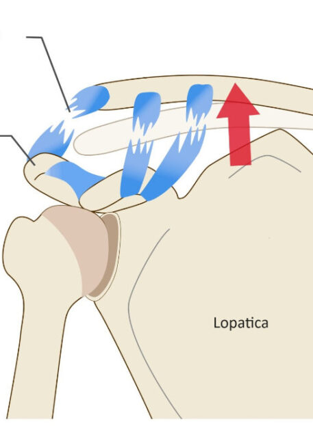 Lezije akromioklavikularnega sklepa
