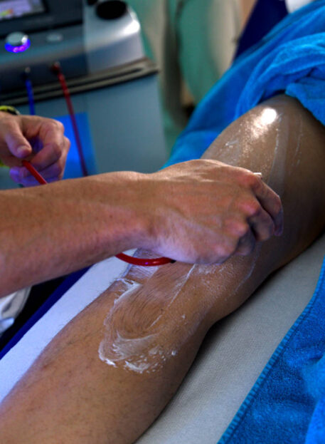 lezije krojaške mišice